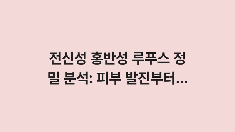 systemic lupus erythematosus analysis